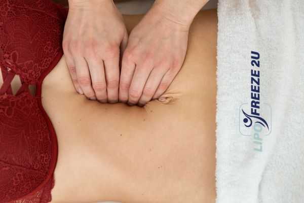diastasis recti treatment Kensington