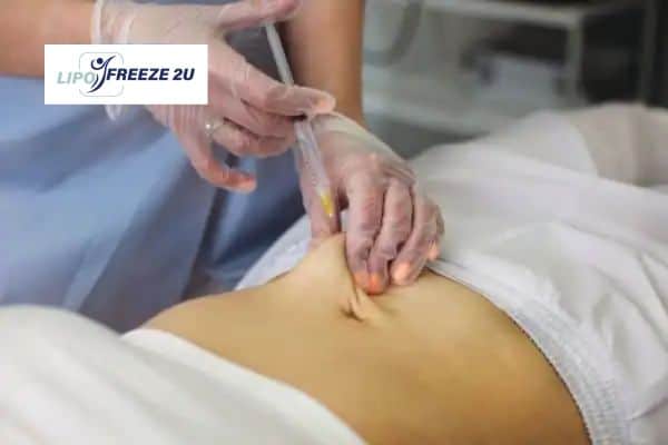 How Does Aqualyx Fat Dissolving Injection Work to Break Down Fat Kensington?