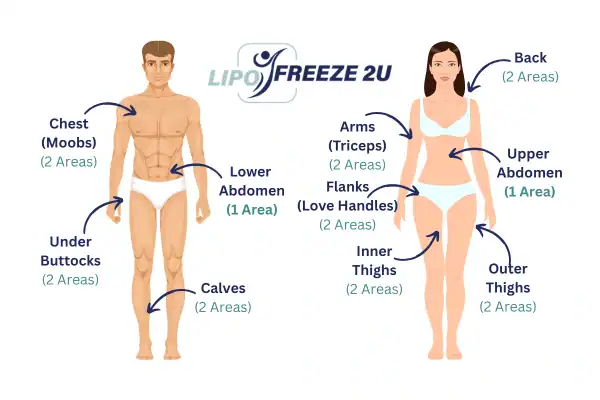 Areas you can have fat freezing treatment Kensington