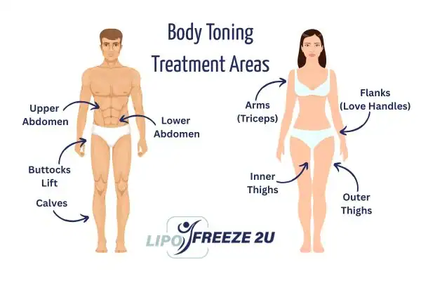 Graphic showing where you can have Body toning Treatment Kensington on your body