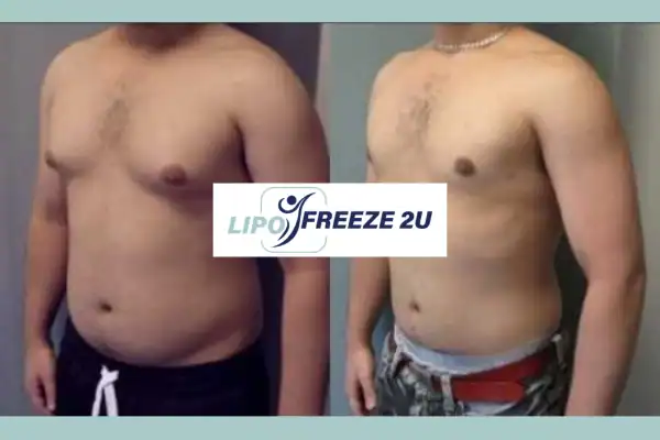 How Long Does It Take to See Results Kensington?