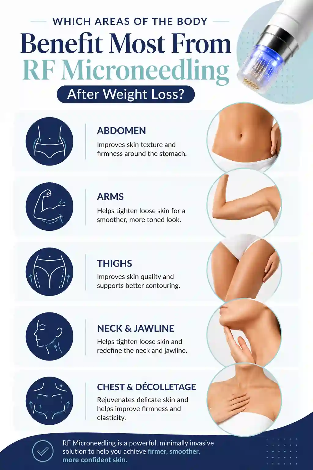 Which Areas of the Body Benefit Most From RF Microneedling After Weight Loss Kensington